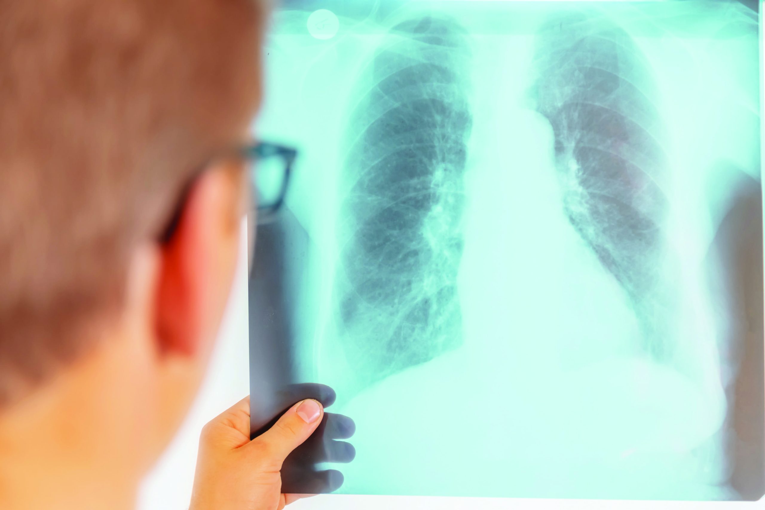 Using occupational health software to monitor Silicosis